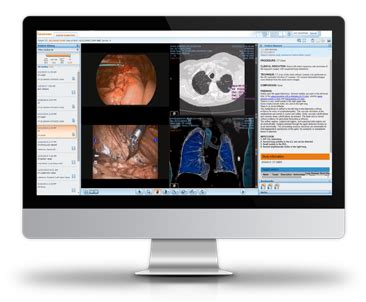 CARESTREAM Vue Motion User Guide.